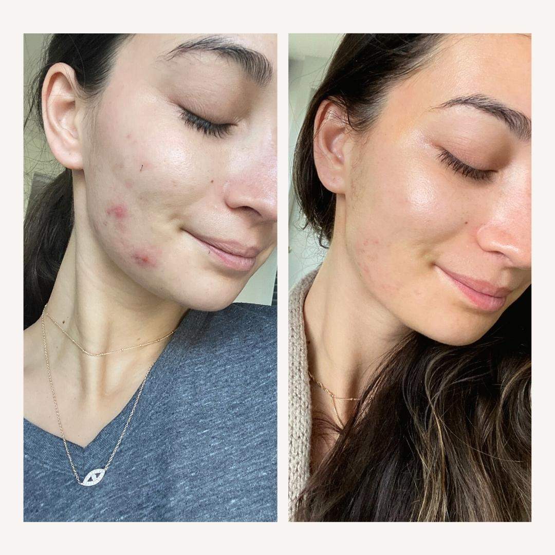 Hyaluronic Acid 2% + B5 Serum