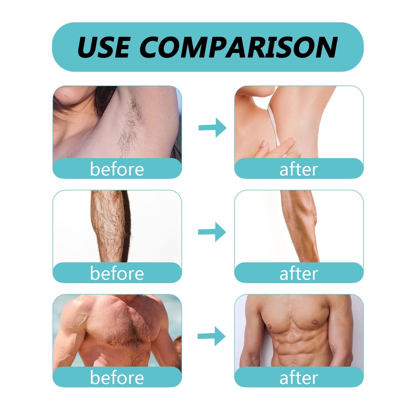 Ecrin Hair Remover Spray