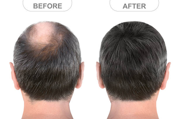 Alif Ahlam Herbs Hair Oil
