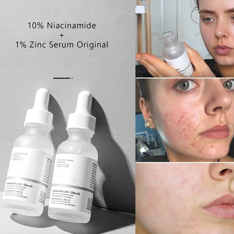 Ordinary Nicotinamide Serum - Ant-Wrinkle Fade Dark Spots Vitamin C Whitening Facial Serum Skincare Essence