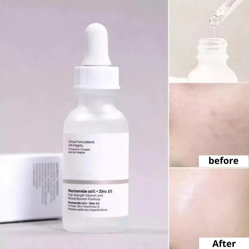 Ordinary Nicotinamide Serum - Ant-Wrinkle Fade Dark Spots Vitamin C Whitening Facial Serum Skincare Essence