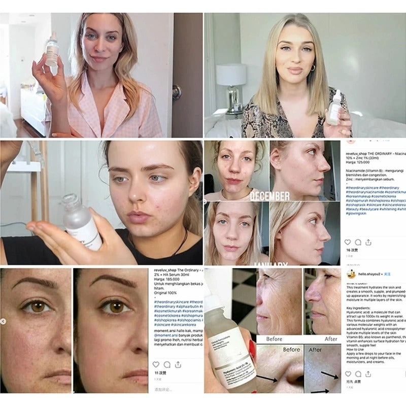 BIOAQUA EXFOLIATING GEL + ORDINARY NICOTINAMIDE SERUM -DEAL 1