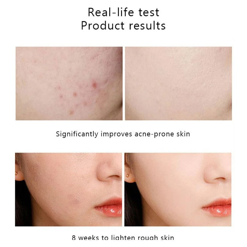 Ordinary Nicotinamide Serum - Ant-Wrinkle Fade Dark Spots Vitamin C Whitening Facial Serum Skincare Essence