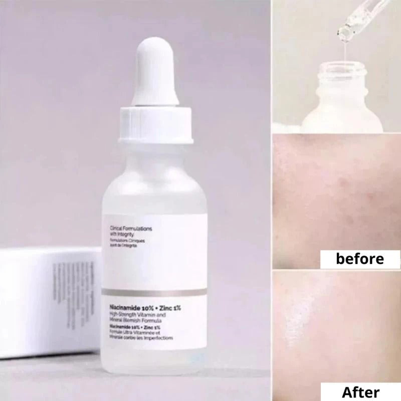 Ordinary Nicotinamide Serum - Ant-Wrinkle Fade Dark Spots Vitamin C Whitening Facial Serum Skincare Essence