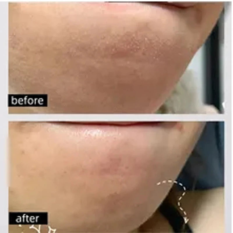 BIOAQUA EXFOLIATING GEL + ORDINARY NICOTINAMIDE SERUM -DEAL 1
